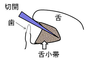 診療疾患画像