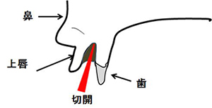 診療疾患画像