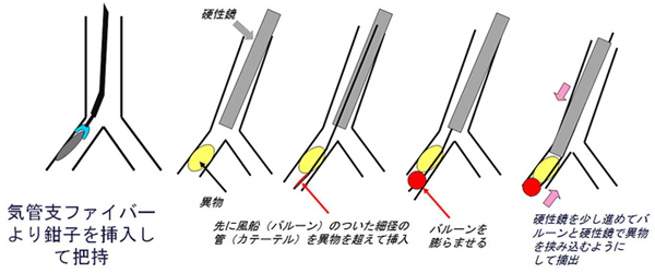 診療疾患画像