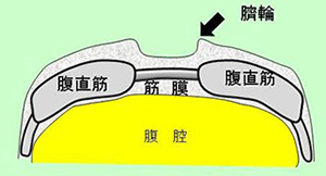 診療疾患画像