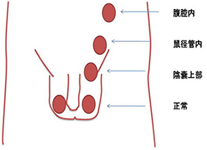 診療疾患画像