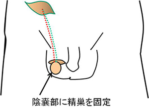 診療疾患画像