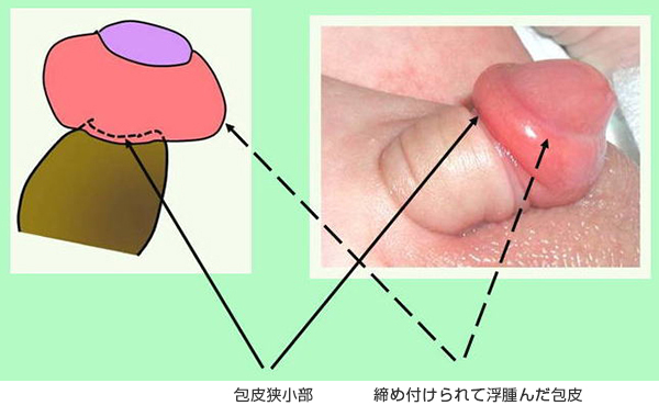 診療疾患画像