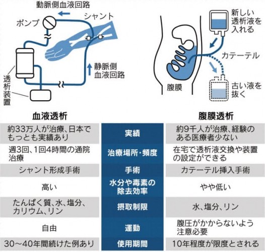 日経PDとHD